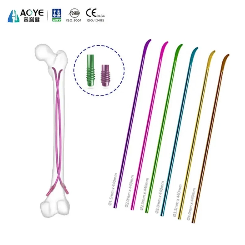Clou élastique en titane | Implant intramédullaire flexible pour fractures